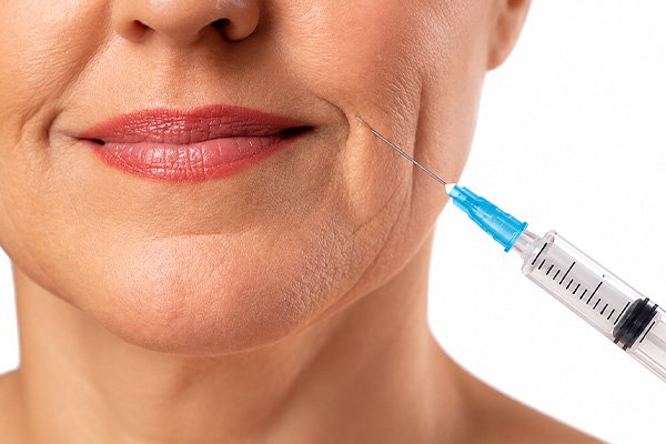 rejuvenecimiento facial