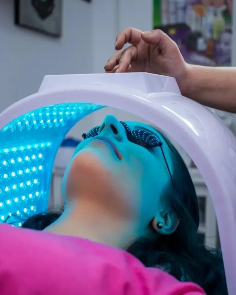 fototerapia