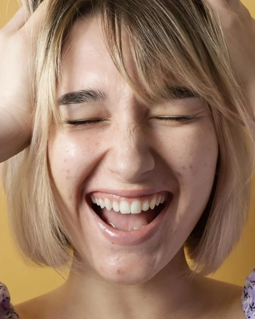 sonrisa gingival